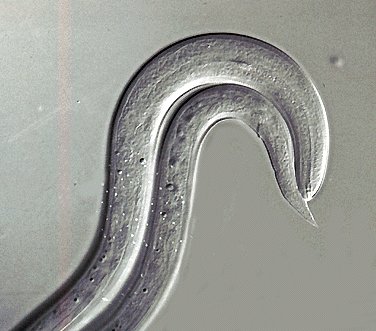 Crenosoma vulpis - larva da lavaggio tracheale